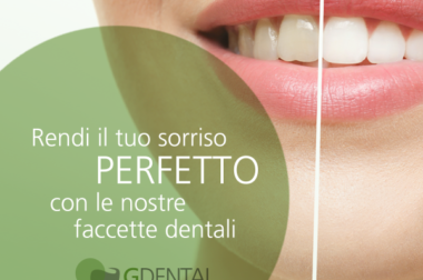 Se vuoi avere un sorriso perfetto, le faccette dentali potrebbero essere il rimedio giusto per te