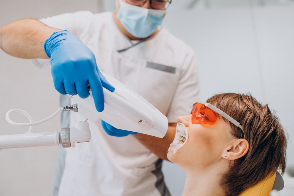 Sbiancamento dentale domiciliare: guida al trattamento